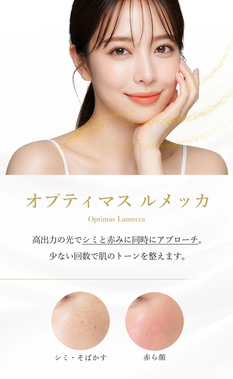 オプティマスルメッカ
