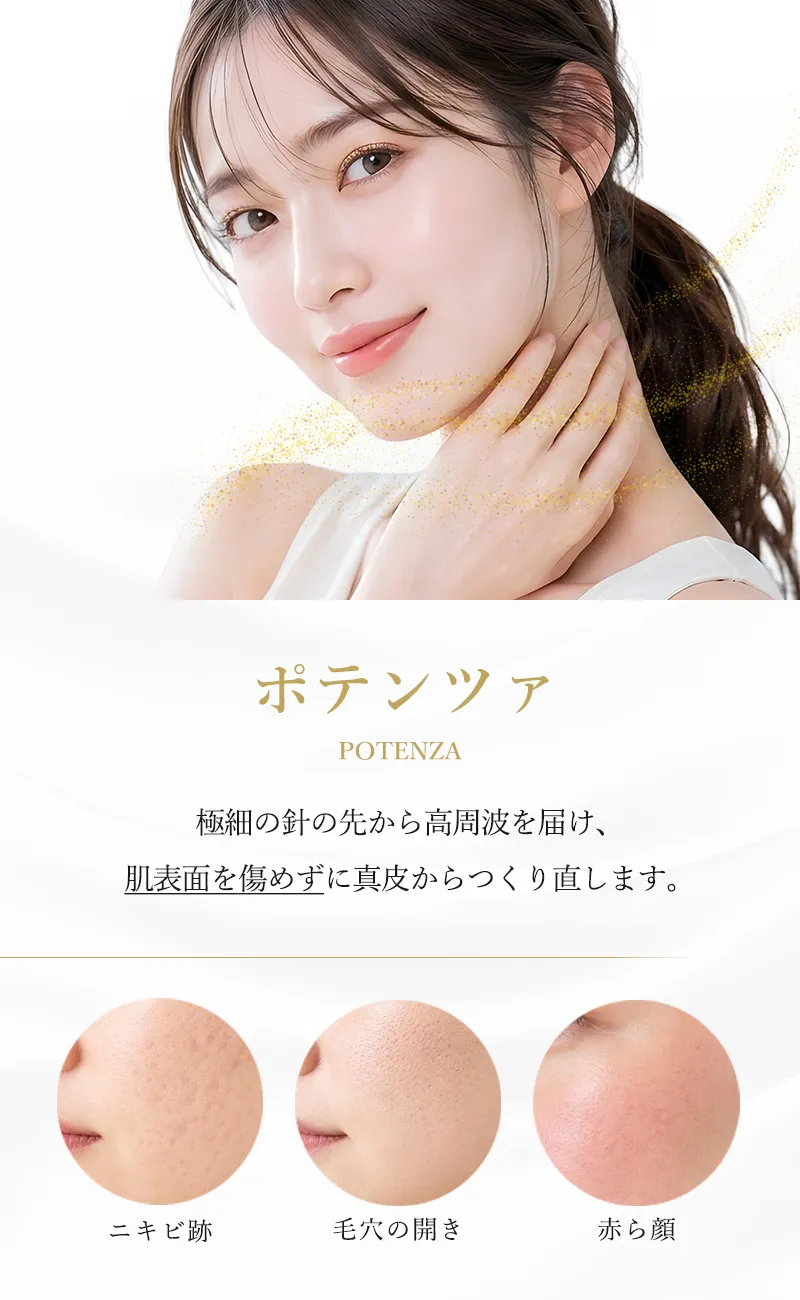 ポテンツァ