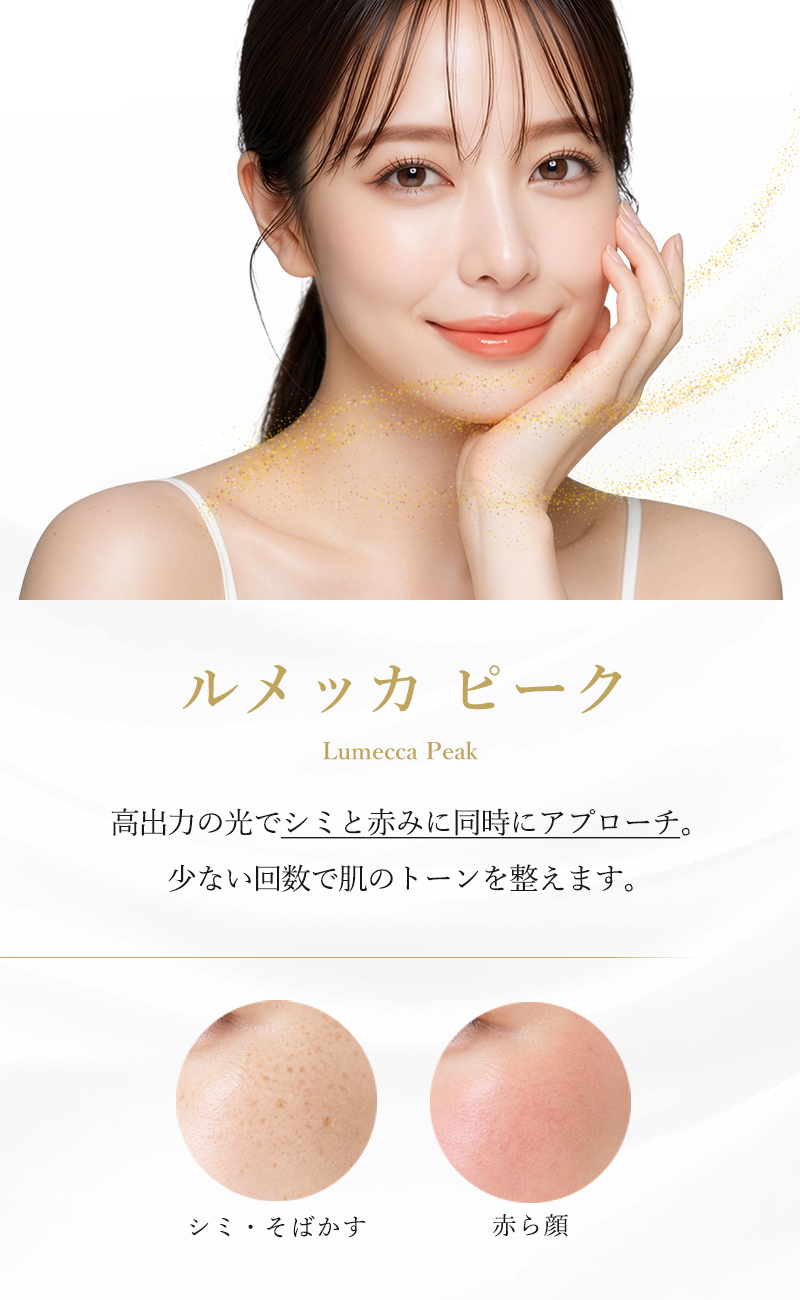 オプティマスルメッカ
